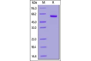 Mouse Properdin, His Tag on  under reducing (R) condition. (CFP Protein (AA 23-464) (His tag))