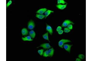 Immunofluorescence staining of Hela cells with ABIN7152141 at 1:100, counter-stained with DAPI. (PERK Antikörper  (AA 115-330))