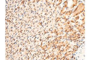 Immunohistochemistry (IHC) image for anti-Tumor Protein P73 (TP73) (pTyr99) antibody (ABIN6256817)
