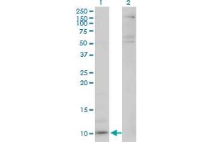 Western Blot analysis of CXCL5 expression in transfected 293T cell line by CXCL5 monoclonal antibody (M03), clone M1. (CXCL5 Antikörper  (AA 1-114))