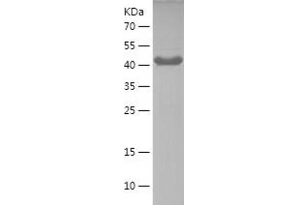 ATG13 Protein (AA 297-517) (His-IF2DI Tag)