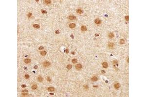 IHC analysis of FFPE mouse brain section using SIRT1 antibody at 1:25.