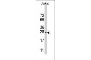 Western blot analysis of CLDN1 Antibody (Loop1) in Jurkat cell line lysates (35ug/lane).