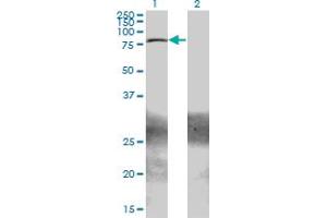 Western Blot analysis of ZBTB33 expression in transfected 293T cell line by ZBTB33 monoclonal antibody (M01A), clone 2B2. (ZBTB33 Antikörper  (AA 564-673))