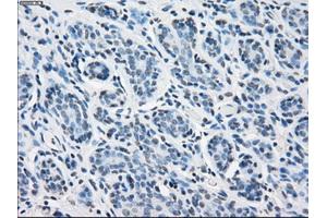 Immunohistochemical staining of paraffin-embedded breast tissue using anti-PSMA7 mouse monoclonal antibody. (PSMA7 Antikörper)