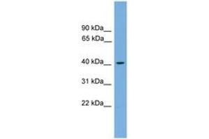 Image no. 1 for anti-Acetyl-CoA Acetyltransferase 1 (ACAT1) (AA 143-192) antibody (ABIN6745050) (ACAT1 Antikörper  (AA 143-192))