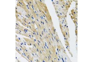 Immunohistochemistry of paraffin-embedded mouse heart using COPB2 antibody (ABIN5974232) at dilution of 1/100 (40x lens). (COPB2 Antikörper)