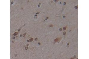 IHC-P analysis of Human Tissue, with DAB staining. (JNK Antikörper  (AA 145-419))