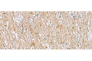 Immunohistochemistry of paraffin-embedded Human brain tissue using LRRC49 Polyclonal Antibody at dilution of 1:40(x200) (LRRC49 Antikörper)