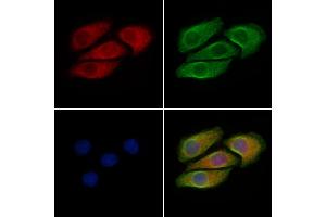ABIN6256588 and ABIN6267381 staining Hela cells(4h of LPS treatment) by IF/ICC. (BRAF Antikörper  (pThr599))