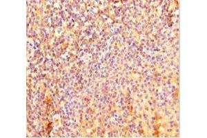 Immunohistochemistry of paraffin-embedded human tonsil tissue using ABIN7157778 at dilution of 1:100 (IL4I1 Antikörper  (AA 139-339))