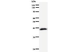 Western Blotting (WB) image for anti-CSRP2 Binding Protein (CSRP2BP) antibody (ABIN931052) (CSRP2BP Antikörper)