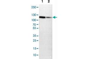 Western Blot analysis of Lane 1: NIH-3T3 cell lysate (mouse embryonic fibroblast cells) and Lane 2: NBT-II cell lysate (Wistar rat bladder tumor cells) with MCM3 polyclonal antibody . (MCM3 Antikörper)
