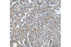 IHC analysis of ACE using anti-ACE antibody (ABIN3043777).