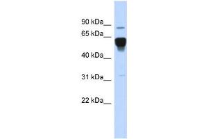 WB Suggested Anti-NR4A2 Antibody Titration:  0. (NR4A2 Antikörper  (Middle Region))