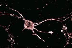 Immunofluorescence (IF) image for anti-Dynein, Light Chain, LC8-Type 1 (DYNLL1) (AA 1-89) antibody (ABIN968140)
