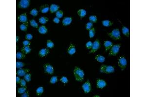 IF analysis of EDC4 using anti-EDC4 antibody (ABIN7599694). (EDC4 Antikörper  (AA 1082-1388))