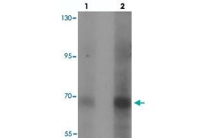 Western blot analysis of CCDC22 in 293 cell lysate with CCDC22 polyclonal antibody  at (lane 1) 1 and (lane 2) 2 ug/mL. (CCDC22 Antikörper  (N-Term))