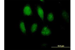 Immunofluorescence of purified MaxPab antibody to MLKL on HeLa cell. (MLKL Antikörper  (AA 1-471))