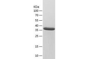 Western Blotting (WB) image for Oligonucleotide/oligosaccharide-Binding Fold Containing 1 (OBFC1) (AA 1-368) protein (His tag) (ABIN7124258) (OBFC1 Protein (AA 1-368) (His tag))