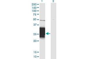 Western Blot analysis of ZNF428 expression in transfected 293T cell line by ZNF428 monoclonal antibody (M01), clone 3H4. (ZNF428 Antikörper  (AA 1-188))