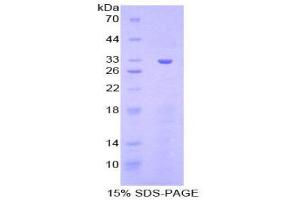 SDS-PAGE (SDS) image for Checkpoint Kinase 1 (CHEK1) (AA 194-446) protein (His tag) (ABIN1879657)