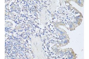 Immunohistochemistry of paraffin-embedded rat lung using CASP3 antibody (ABIN6292881) at dilution of 1:100 (40x lens). (Caspase 3 Antikörper)