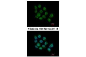 ICC/IF Image Immunofluorescence analysis of paraformaldehyde-fixed A431, using DDX5, antibody at 1:500 dilution.