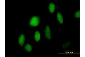 Immunofluorescence of purified MaxPab antibody to ZNF473 on HeLa cell. (ZNF473 Antikörper  (AA 1-871))