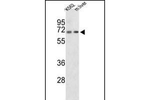 Western blot analysis of CROT Antibody (N-term) (ABIN653328 and ABIN2842818) in K562 cell line and mouse liver tissue lysates (35 μg/lane). (CROT Antikörper  (N-Term))