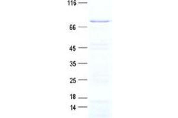 Ubiquilin 3 Protein (UBQLN3) (His tag)