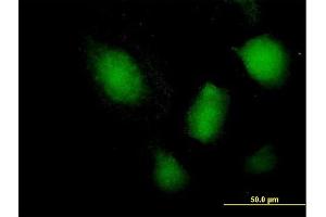 Immunofluorescence of purified MaxPab antibody to NFATC3 on HeLa cell.
