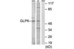 Western blot analysis of extracts from 293/Jurkat cells, using GK Antibody. (Glycerol Kinase Antikörper  (AA 461-510))