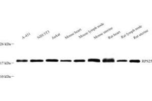 Western blot analysis of RPS25 (ABIN7075449)at dilution of 1: 1000 (RPS25 Antikörper)