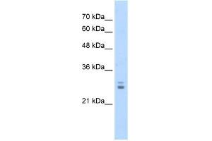 WB Suggested Anti-KCTD11 Antibody Titration:  1. (KCTD11 Antikörper  (N-Term))