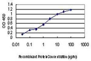 Detection limit for recombinant GST tagged CDKL4 is approximately 0. (CDKL4 Antikörper  (AA 196-295))
