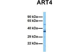 Host:  Rabbit  Target Name:  ART4  Sample Tissue:  Human Stomach Tumor  Antibody Dilution:  1. (ART4 Antikörper  (Middle Region))