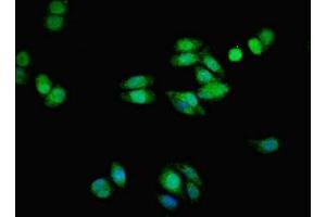 Immunofluorescent analysis of HepG2 cells using ABIN7173051 at dilution of 1:100 and Alexa Fluor 488-congugated AffiniPure Goat Anti-Rabbit IgG(H+L) (TMEM139 Antikörper  (AA 56-216))