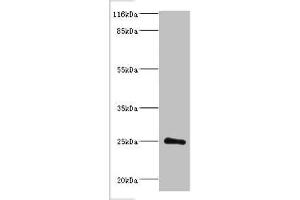 Western blot All lanes: Protein DGCR6L antibody at 2 μg/mL + Mouse brain tissue Secondary Goat polyclonal to rabbit IgG at 1/10000 dilution Predicted band size: 25 kDa Observed band size: 25 kDa (DGCR6L Antikörper  (AA 1-220))