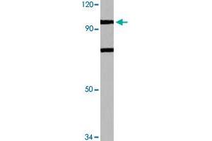 Western blot analysis of HeLa cell lysate with N4BP1 polyclonal antibody  at 1:500 dilution. (N4BP1 Antikörper)