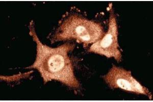 Immunofluorescence staining of human endothelial cells. (TIAL1 Antikörper  (AA 161-365))