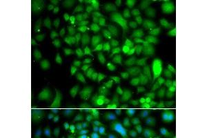 Immunofluorescence analysis of A549 cells using CSRP2BP Polyclonal Antibody (CSRP2BP Antikörper)
