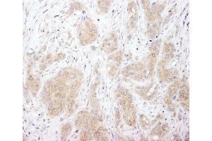 Immunohistochemistry (IHC) image for anti-Sorting Nexin 1 (SNX1) (C-Term) antibody (ABIN7449439)