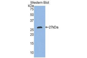 Western Blotting (WB) image for anti-Ectodysplasin A (EDA) (AA 141-378) antibody (ABIN1858684) (Ectodysplasin A Antikörper  (AA 141-378))