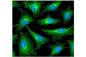 ICC/IF analysis of PRDX6 in HeLa cells line, stained with DAPI (Blue) for nucleus staining and monoclonal anti-human PRDX6 antibody (1:100) with goat anti-mouse IgG-Alexa fluor 488 conjugate (Green). (Peroxiredoxin 6 Antikörper  (AA 1-224))