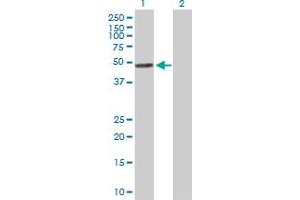 Western Blot analysis of TYMP expression in transfected 293T cell line by TYMP MaxPab polyclonal antibody. (Thymidine Phosphorylase Antikörper  (AA 1-482))