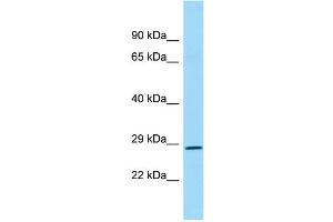 WB Suggested Anti-REP15 Antibody Titration: 1. (REP15 Antikörper  (N-Term))