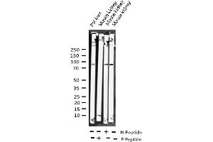 Western blot analysis of Phospho-AhR (Ser36) expression in various lysates (Aryl Hydrocarbon Receptor Antikörper  (pSer36))