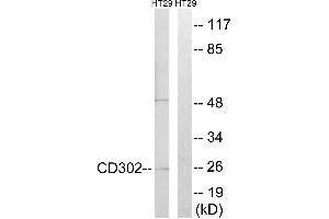 Immunohistochemistry analysis of paraffin-embedded human lymph node tissue using CD302 antibody. (DCL1 Antikörper)