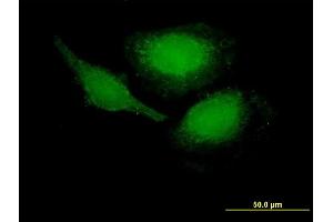 Immunofluorescence of purified MaxPab antibody to PHLDA1 on HeLa cell.